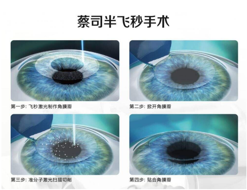 半飞秒激光
