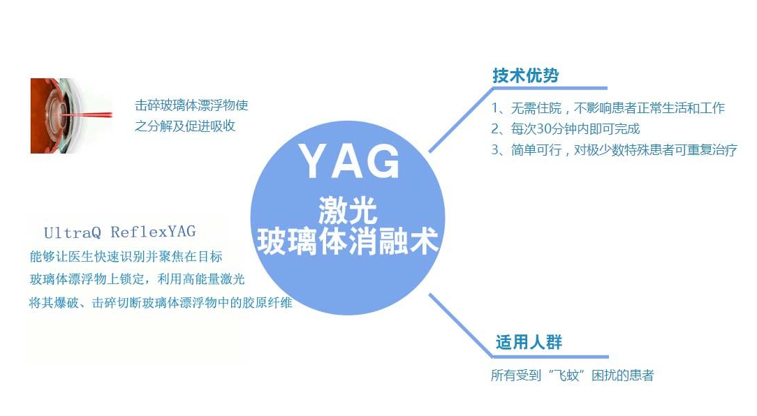 后发障YAG激光术