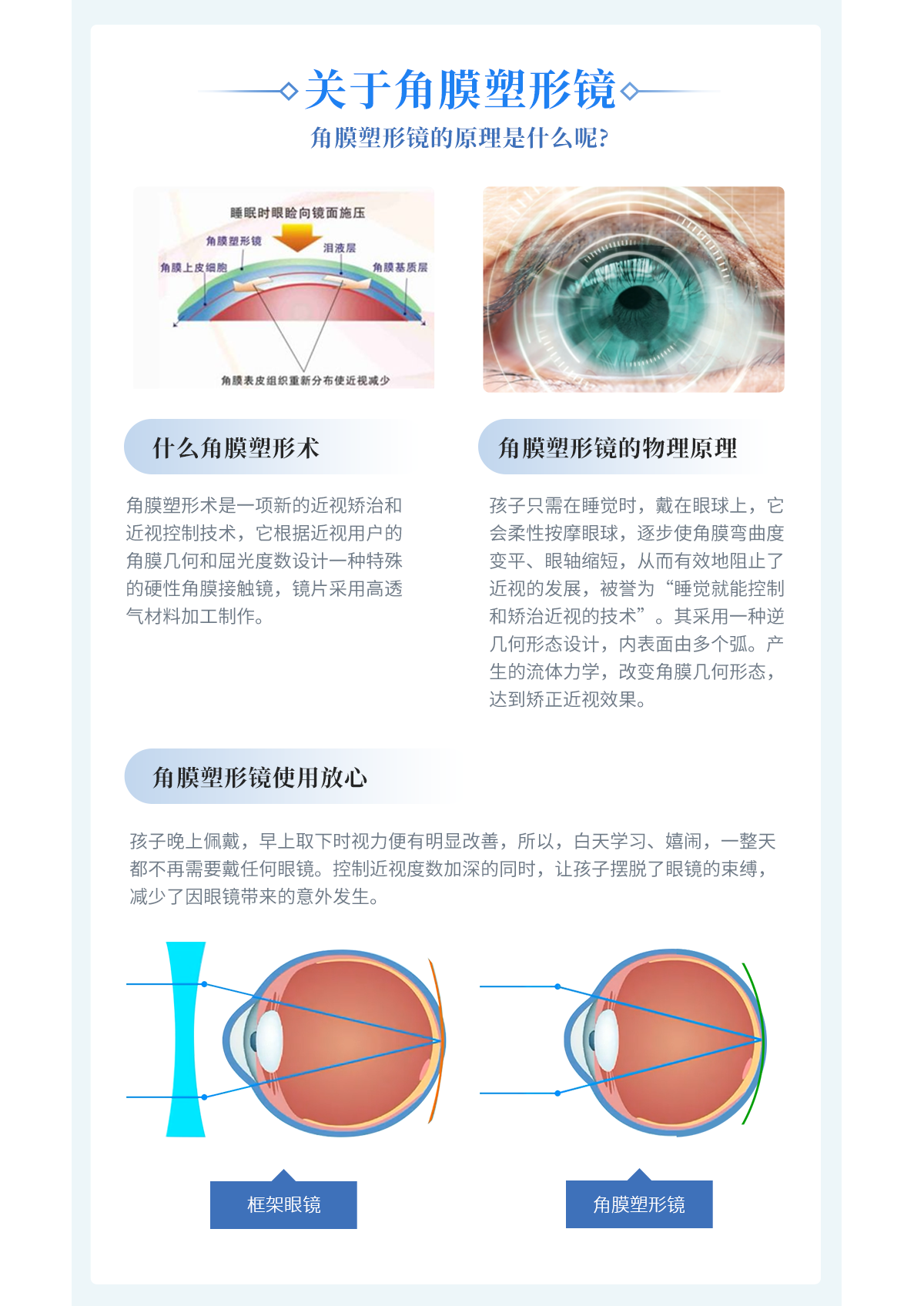 正常眼角膜的形状图片-图库-五毛网