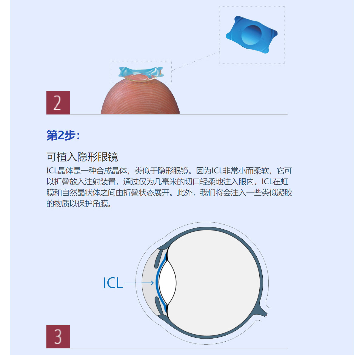 ICL_05