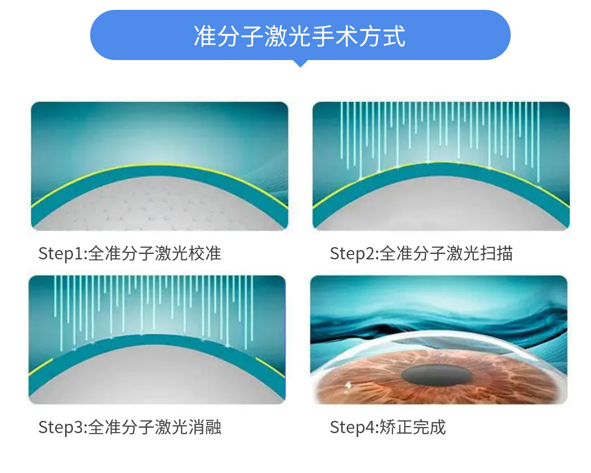 准分子1_03